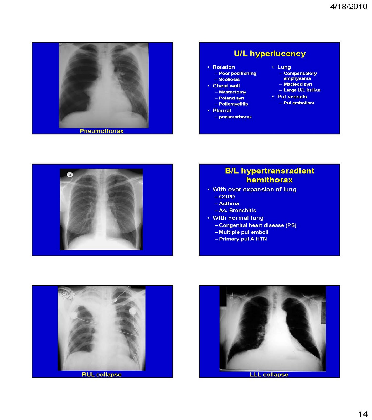 Respiratory Critical Care and Sleep Medicine CHEST XRAY